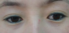 女性紋眼線有哪些危害呢?