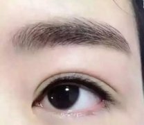 紋美瞳線會不會痛呢?