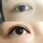 呼市美瞳線紋哪里呢?