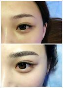 呼市紋眉價(jià)格多少?