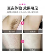 呼和浩特激光脫毛有危險(xiǎn)嗎?